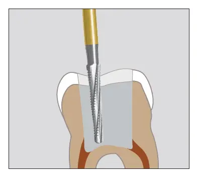 Fresa Quirúrgica Endo Acces C269GKS FG 3u Edenta 2.webp