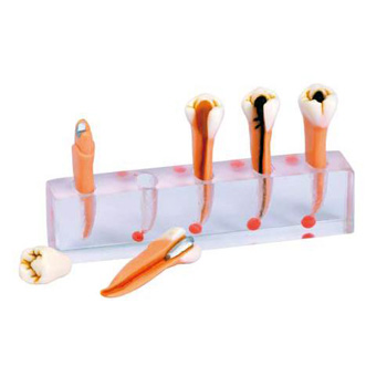 [z9609] Modelo de endodoncia