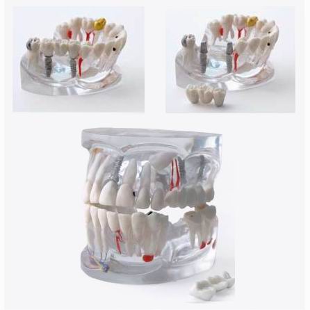 [z9615] Modelo transparente DS8000 Universal