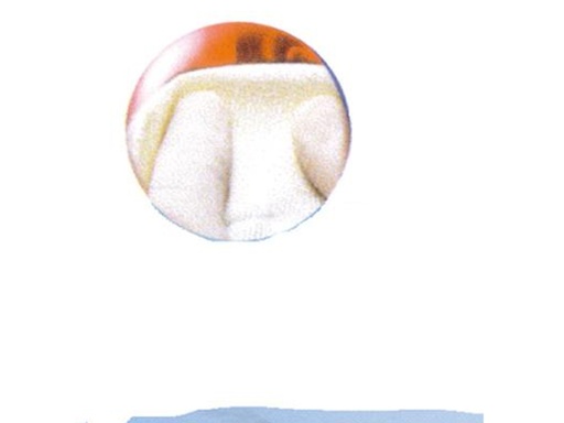 [13909] Surgicel Nu-Knit 12 u. 2,5cm x 2,5cm - Johnson&Johnson